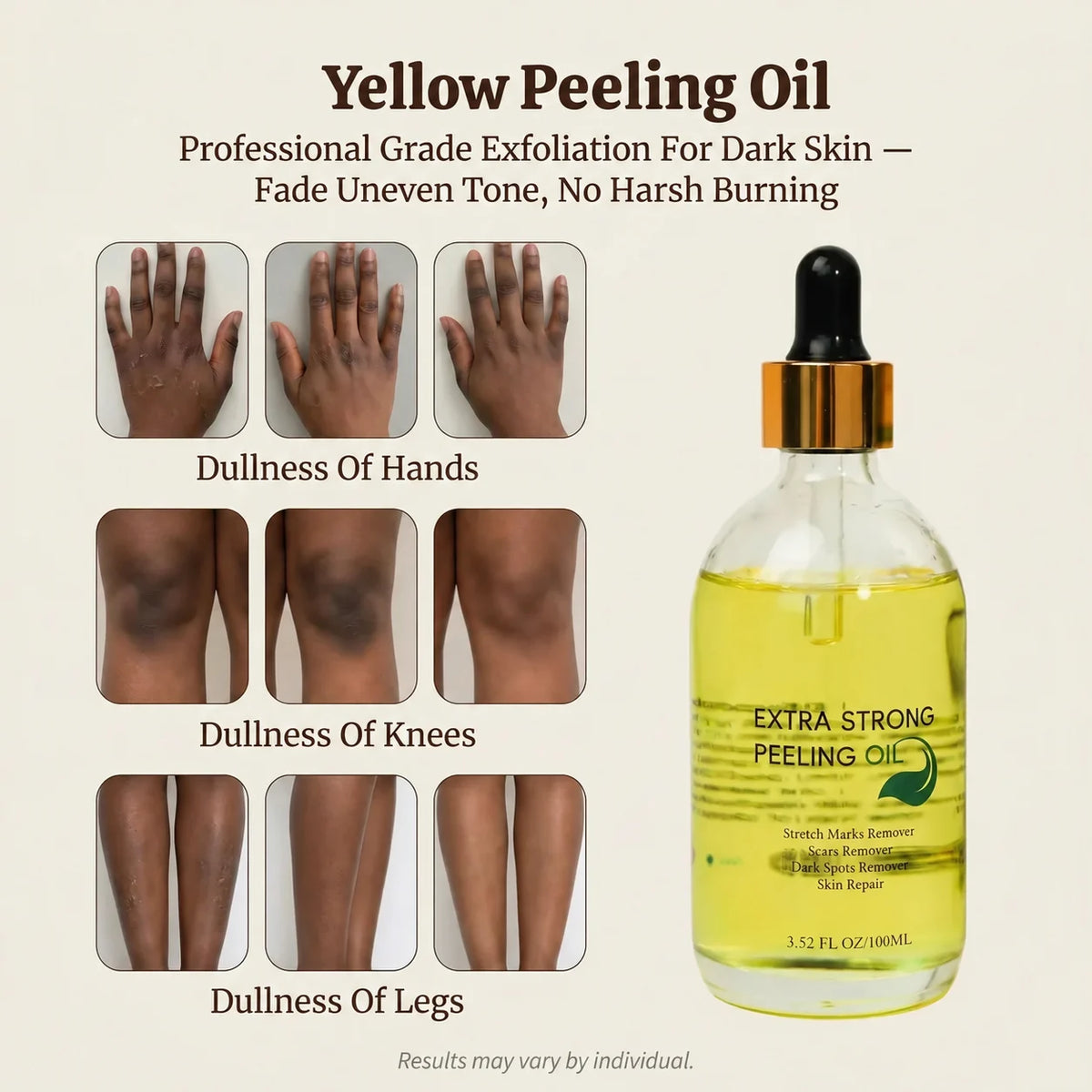 Yellow Peeling Oil: Body Hyperpigmentation Treatment | Fade Dark Spots