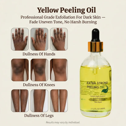Yellow Peeling Oil: Body Hyperpigmentation Treatment | Fade Dark Spots