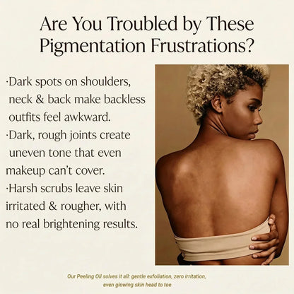 Yellow Peeling Oil: Body Hyperpigmentation Treatment | Fade Dark Spots
